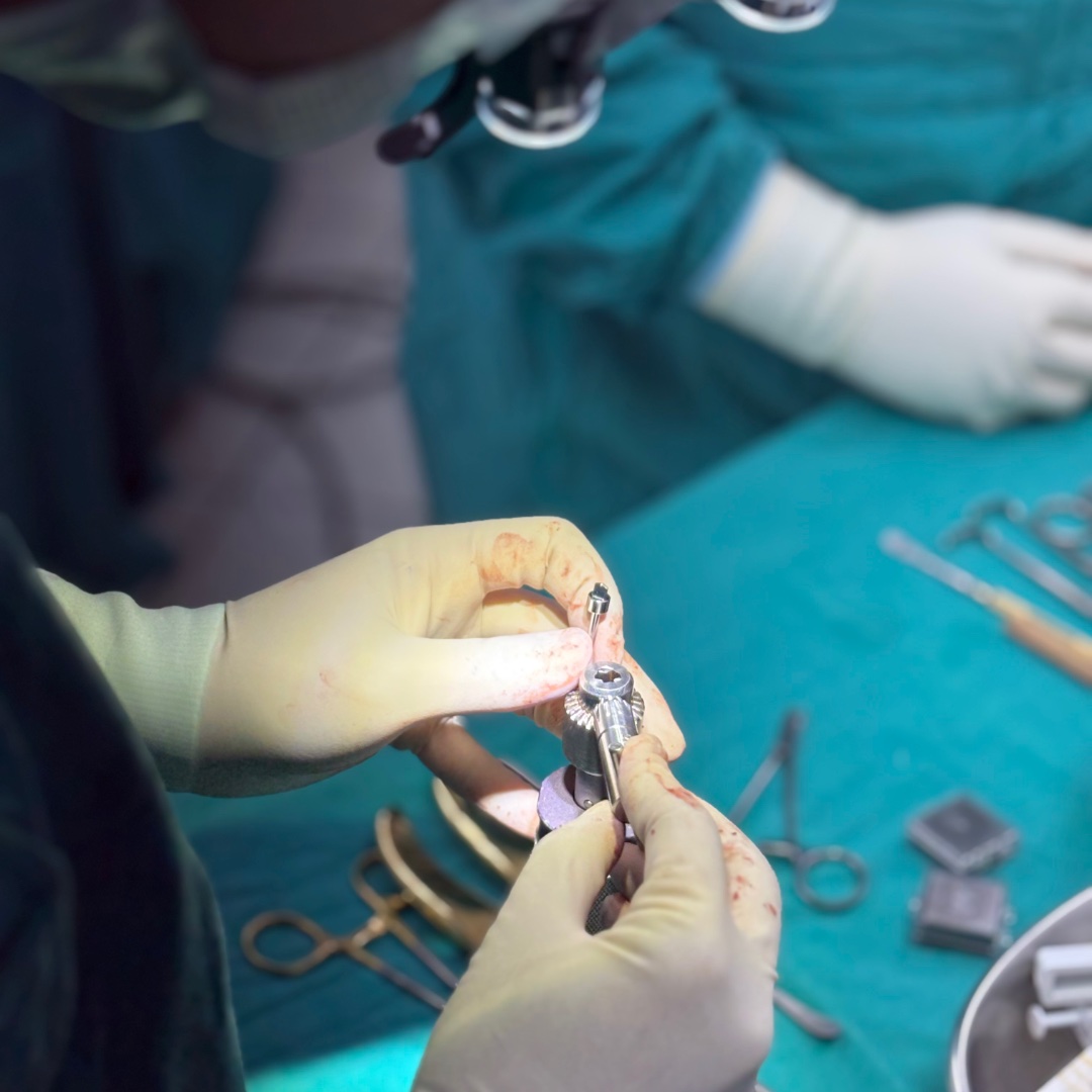 Preparation for brow fixation during endoscopic brow lift