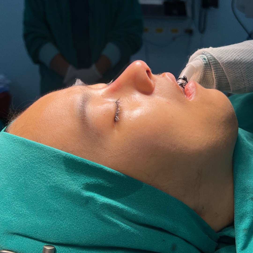 Anesthesia monitoring and patient safety during rhinoplasty surgery